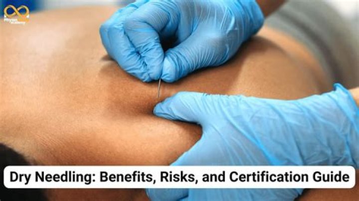 How do I get certified in dry needling?