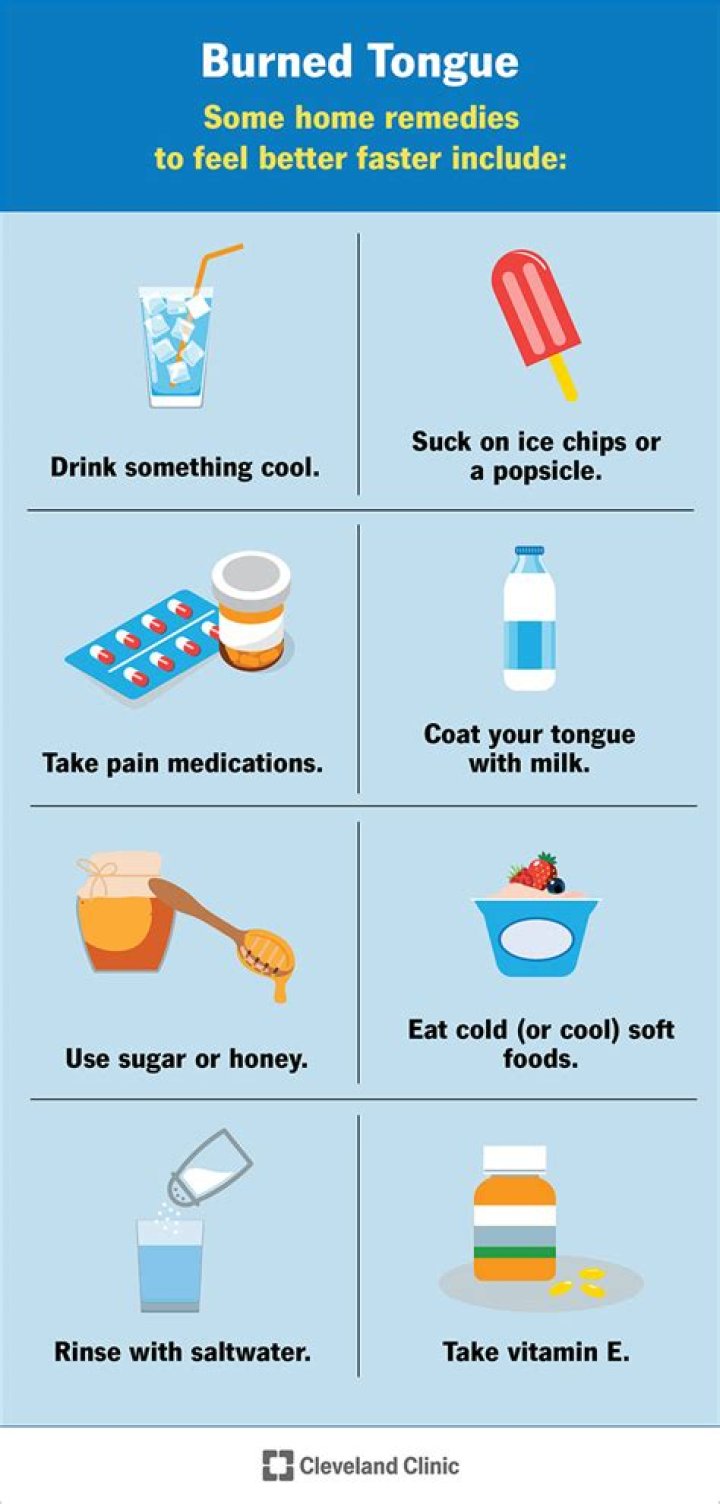 How do you cure a burned tongue?